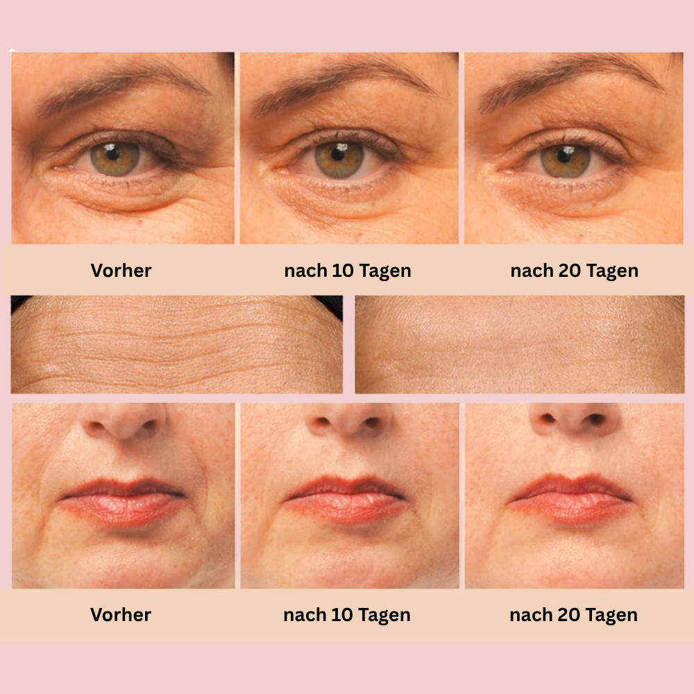 GlowLift